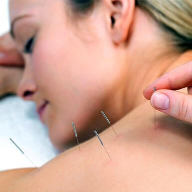 This image shows Acupuncture being done at Oriental herbs and massage Toongabbie